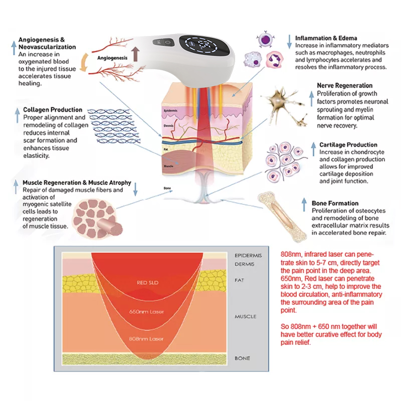 2x808nm Koude Laser Therapie A - Badminton Bag recensie en prijs